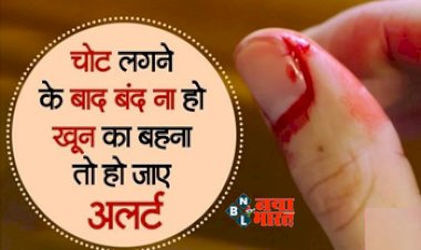 Health Tips : चोट लगने के बाद बिना रुके बहता है खून, तो हो सकती है इस विटामिन की कमी, जाने इसके लक्षण और उपाय...