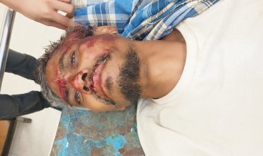 ग्राम अमगसी निवासी व्यक्ति को अज्ञात गाड़ी ने मारी ठोकर,हुई घायल, उदयपुर सीएचसी में इलाज जारी।