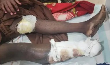 CG - नक्सलियों की कायराना हरकत : IED की चपेट में आया युवक, पैर के उड़े चीथड़े, जख्मी युवक को नक्सलियों ने 17 दिन रखा बंधक, फिर जो किया.....