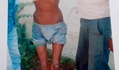 अजमेर से एक मार्मिक अपील : धारू मेड़ता में किसी फैक्ट्री में बोरी उठाने का काम करते थे, इनके ऊपर बोरियां गिर गई, काफी गंभीर चोट के बाद जोधपुर भर्ती करवाया गया, इनकी रीड की हड्डी के नीचे के दो गुटके खराब हो गए और उसके कारण इनका कमर के नीचे का हिस्सा बिलकुल भी  काम नही करता, आप सभी का सहयोग चाहिए...