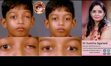 कृतिम आंख क्या व्यक्ति को रौशनी दे सकती है ? जानते है डॉ सुमित्रा अग्रवाल से...