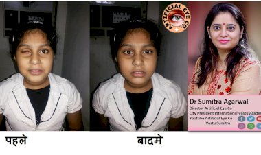 डॉ सुमित्रा से जानेंगे की आंख के नष्ट हो जाने पर कृतिम आंख लगाना क्यों जरुरी है...