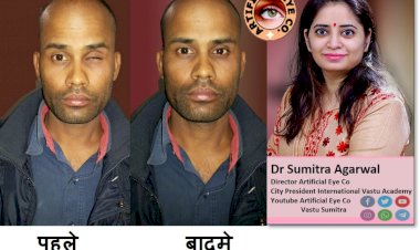 क्या जो रेडीमेड कृतिम आंख पहन रहे है वो बड़ी गलती कर रहे है ? जानते है डॉ सुमित्रा से की कस्टमाइज्ड कृतिम आंख क्यों पहना जाना चाहिए...