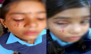 CG -सरकारी स्कूल के हेड मास्टर ने नाबालिग छात्रा को बेरहमी से पीटा, आंखों के नीचे आई गंभीर चोट, DEO ने जारी किए ये आदेश.....