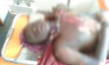 CG - पहाड़ पर स्थित मंदिर के पीछे अधजली अवस्था में मिला युवक, अस्पताल ले जाते वक्त तोड़ा दम, हत्या या आत्महत्या जांच में जुटी पुलिस....