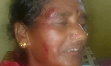 मचहा में दबंगो नें महिला के घर जा कर फोड़ दी सर एफआईआर पुलिस के हाथ खाली पीड़ित असंतुष्ट एस पी से शिकायत जानें पूरा मामला पढ़े पूरी ख़बर