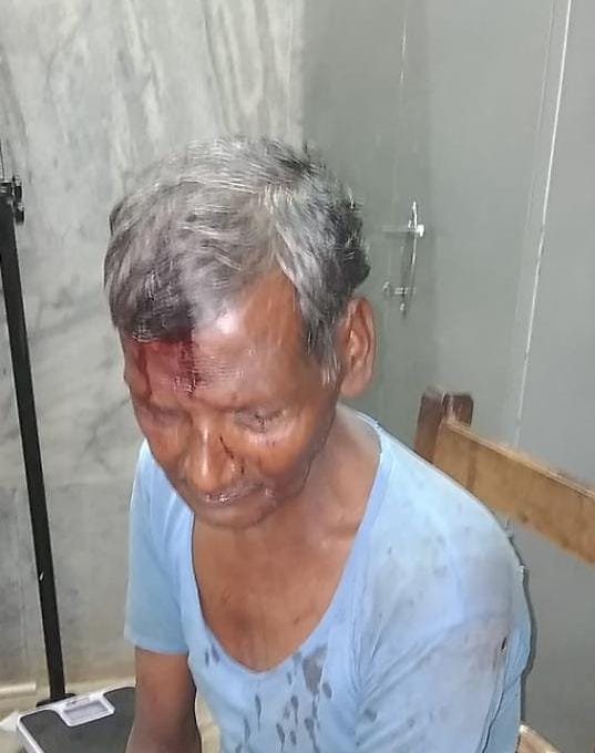 *मामूली विवाद पर किया मारपीट , दिया जान से मारने की धमकी , पीड़ित मांग रहा इंसाफ....*