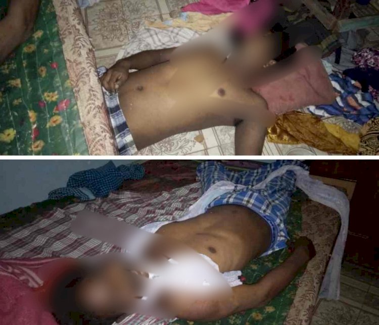 CG बिग न्यूज़ :- इकलौते बेटे ने लगाई फांसी.. आहत पिता भी उसी फंदे पर झूल गया….पिता- पुत्र ने की आत्महत्या घर में एक ही फंदे पर झूलते मिले पिता-पुत्र.....मचा हड़कंप, जांच में जुटी पुलिस….