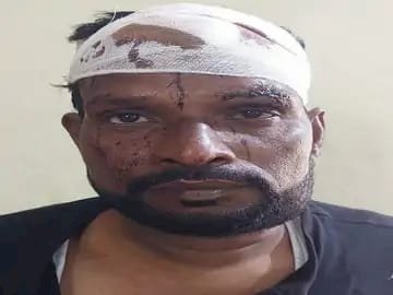 CG- सिरफिरे आशिक ने प्रेमिका को मारा चाकू: गर्लफ्रेंड के घर वालों के सामने ही आशिक ने किया हमला.... परिजनों ने कर दी प्रेमी की पिटाई.... गुस्साए परिजनों ने फोड़ दिया प्रेमी का सिर.... फिर जो हुआ......