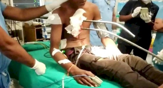OMG : लोहे की सरिया से लदे वाहन से टकराया युवक, सीने के आर-पार हुआ रॉड, फिर जो हुआ, जान कर हो जायेंगे हैरान…..