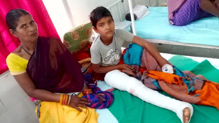 CG:जिला अस्पताल बेमेतरा में पहली बार दो मरीजों का हुआ मेजर आर्थोपेडिक सर्जरी