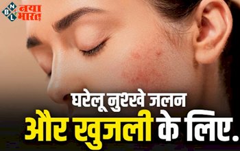 Burning And Itching : घरेलू नुश्खे जलन और खुजली के लिए, ये 5 कारण जानें इससे छुटकारा पाने के उपाय.