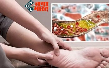 High Cholesterol Symptoms: जब पैरों में होने लगे ऐसी दिक्कतें, तो बढ़ गया है आपका कॉलेस्ट्रॉल , ना करें नजरअंदाज.