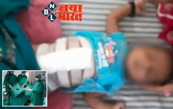 Feet in Fitu : सिर्फ 40 दिन के बच्चे के पेट में पल रहा था बच्चा, डॉक्टरों ने सर्जरी कर निकाला भ्रूण! 5 से 10 लाख बच्चों में एक केस...जाने मामला…