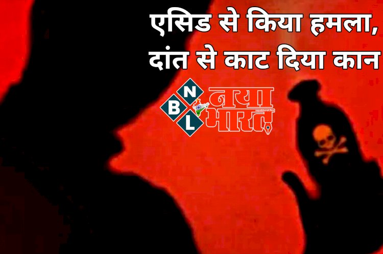 CG में एसिड अटैक: लड़ाई-झगड़ा में बीच बचाव करना पड़ा महंगा.... एसिड से किया हमला.... दांत से काट दिया कान.... एसिड फेंककर घातक हमला करने वाले आरोपियों को पुलिस ने किया गिरफ्तार.... मामला जान रह जाएंगे दंग.....