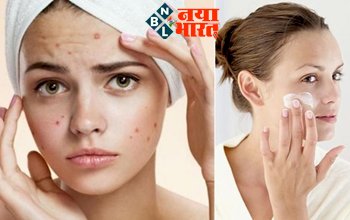 Monsoon Skin Problems: बारिश के दिनों में इन 4 चीजेंसे करें परहेज, वरना चेहरे पर हो जाएंगे फुंसी-पिंपल्स...