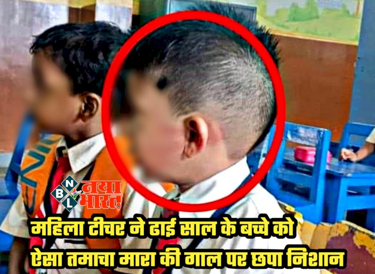 CG- महिला टीचर सस्पेंड: स्कूल में बच्चे से मारपीट... शिक्षिका ने ढाई साल के बच्चे को ऐसा तमाचा मारा की गाल पर छपा निशान... बच्चे के साथ दरिंदगी दिखाने वाली शिक्षिका निलंबित... देखें दिल दहला देने वाली तस्वीर....