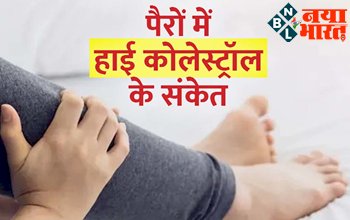 High Cholesterol Signs: पैरों में दिखने वाले हाई कोलेस्ट्रॉल लेवल के संकेत और लक्षण, ना करें इग्नोर, लाइफस्टाइल में करें ये बदलाव...