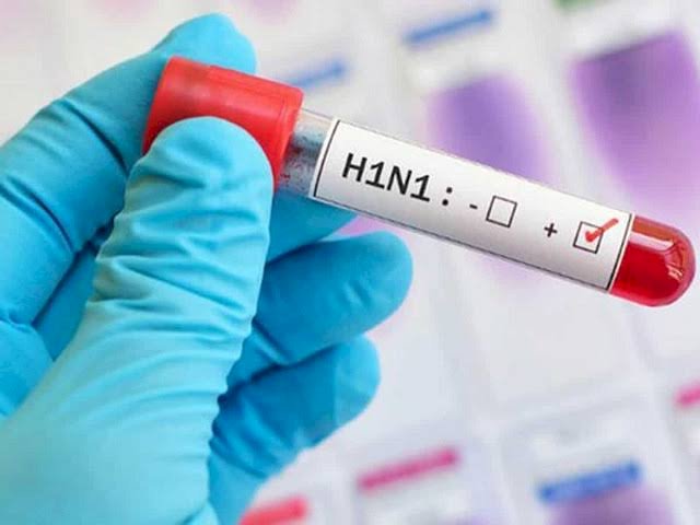 CG- स्वास्थ्य विभाग BIG Alert: छत्तीसगढ़ में स्वाइन फ्लू की दस्तक... सात जिलों में 11 मामले मिले... मेडिकल कॉलेजों, CMHO व सिविल सर्जन्स को निर्देश जारी... स्वास्थ्य मंत्री ने इन बीमारियों से किया सचेत......