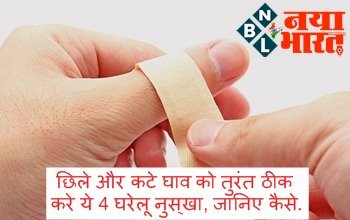Home Remedies To Heal Wounds : छिले और कटे घाव को तुरंत ठीक करे ये 4 घरेलू नुस्खा, जानिए कैसे...