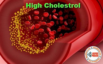 High Cholestrol: कोलेस्ट्रॉल की जांच कराते समय ध्यान रखें ये बातें, खतरे में डाल सकती हैं ये गलतियां....