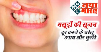 Gum Swelling : मसूड़ों की सूजन को दूर करने के लिए रामबाण है ये है घरेलू उपाय और नुस्खे, जानिये.....
