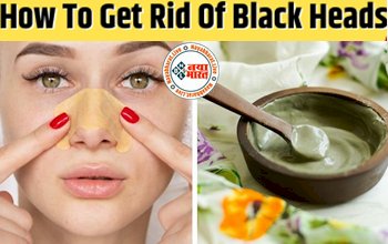 How To Get Rid Of Black Heads: सनटैन हटाने से लेकर ब्लैकहेड्स से छुटकारा पाने के लिए, लगाएं मुल्तानी मिट्टी से बने फेस पैक...जानिए इसे बनाने का सही तरीका...