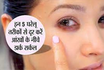 Dark Circles: इन 5 घरेलू तरीकों से दूर करें आंखों के नीचे डार्क सर्कल....