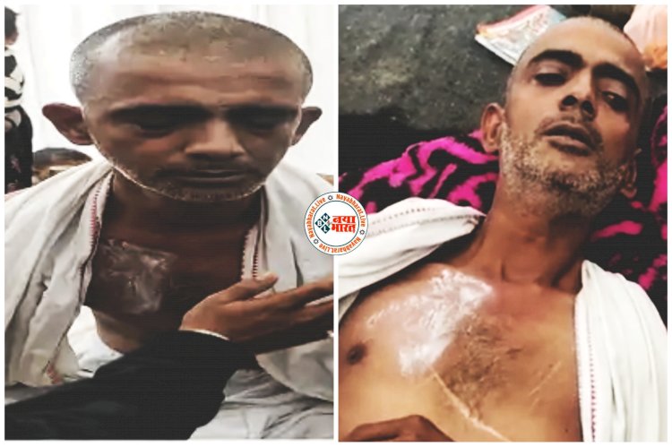 CG- आंदोलनकारी पर हमला: शराब दुकान हटाने प्रदर्शन, शराबी आया और भूख हड़ताल पर बैठे 'गांधी' को बेल्ट से मारा, फिर जो हुआ....