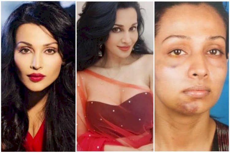 बॉयफ्रेंड ने की मशहूर एक्ट्रेस की बेरहमी से पिटाई: इतना मारा कि टूट गया जबड़ा, लेने वाला था जान, यौन शोषण भी.....