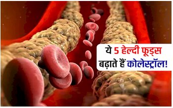 Cholesterol Rich Foods: नसों में कोलेस्ट्रॉल को जमाने का काम करते हैं ये 5 हेल्दी फूड्स! जानें सर्दी में कोलेस्ट्रॉल बढ़ाने वाले हेल्दी फूड्स....