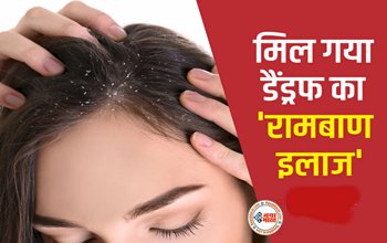 Hair Care: डैंड्रफ और हेयरफॉल का रामबाण इलाज मिल गया, आजमाइए ये उपाय घर बैठे ऐसे तैयार करें आयुर्वेदिक दवा....