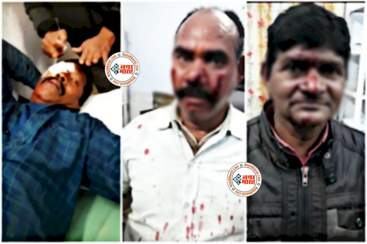CG- वर्कशॉप में कबाड़ चोरों ने किया हमला: SECL वर्कशॉप में घुसे बदमाश... हथियारों से हमला कर वर्कशॉप का सामान लूटा... सुरक्षाकर्मी ने खोयी एक आंख की रोशनी... कई घायल.....