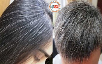 White Hair : कम उम्र में बाल सफेद होने की समस्या से परेशान? अपनाएं ये 5 रामबाण इलाज, दूर करेंगे सफेद बाल की समस्या...