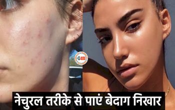 Flawless Skin: डाइट और लाइफस्टाइल में 5 आसान बदलाव करके पाएं बेदाग निखार, नेचुरल तरीके से हटेंगे स्किन के दाग-धब्बे....