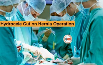 Hydrocele Cut on Hernia Operation : डॉक्टर की बड़ी लापरवाही! हर्निया के ऑपरेशन में काट दिया मरीज का प्राइवेट पार्ट, अब है फरार, ये है पूरा मामला...