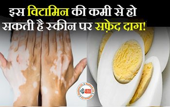 White Spots: इस विटामिन की कमी से हो सकती है स्कीन पर सफ़ेद दाग! इन भयंकर बीमारियों की चपेट में भी आ सकते हैं आप...