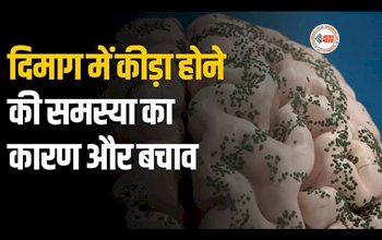 Ways to Avoid Brain Worms : दिमाग में कीड़े पड़ने के ये है लक्षण, हो जाएं सतर्क नहीं तो खोखली हो जाएगी खोपड़ी, जाने इससे बचाव के उपाय...
