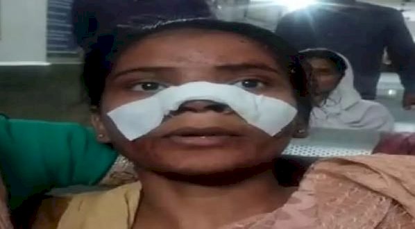CG - बदमाशों ने युवती के साथ की दरिंदगी : दादा और पिता को बचाने पहुंची युवती के साथ बदमाशों ने की ये घिनौनी हरकत, फिर काट दी नाक, लहूलुहान हालत में अस्पताल में किया भर्ती.....
