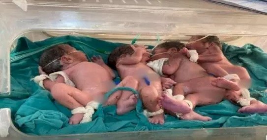 CG - महिला ने दिया 4 बच्चों का जन्म : तीन बीवियों वाले शख्स के घर गूंजी किलकारी, महिला ने 4 बच्चों को एक साथ दिया जन्म, जच्चा-बच्चा दोनों सुरक्षित, सोनोग्राफी में दिखे थे तीन बच्चे, पैदा हुए 4… डॉक्टर भी हैरान...